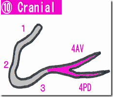 血管造影（CAG) cranial rca